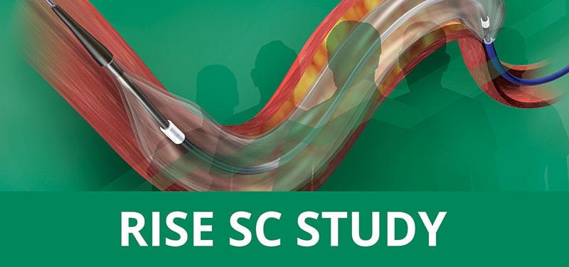 BIOSENSORS INTERNATIONAL ANNOUNCES ENROLLMENT OF FIRST PATIENT IN NEW SEMI-COMPLIANT BALLOON TRIAL “RISE SC STUDY".